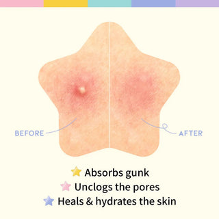 OOTD Star Spot Patch Parches hidrocoloides dermatológicos para granitos de estrellas