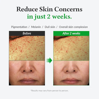 Dr. Althea - Sérum facial Gentle Vitamin C Serum