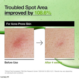 Anua - Sérum Facial Calmante Azelaic Acid 10 Hyaluron Redness Soothing Serum